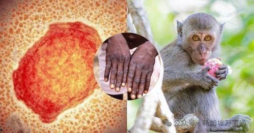 猴痘吃瓜,揭秘病毒传播与防控措施  第3张