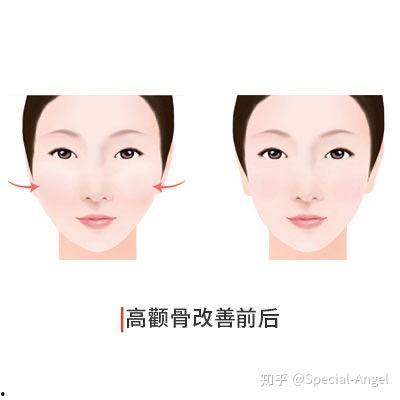 吃瓜脸是什么脸型,独特脸型背后的魅力与特点  第3张